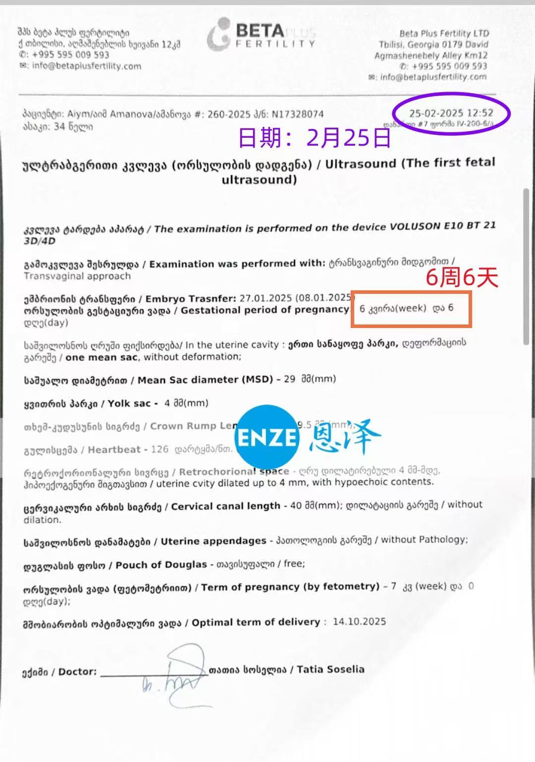 格鲁吉亚试管婴儿助孕爱心使者6周产检顺利通过