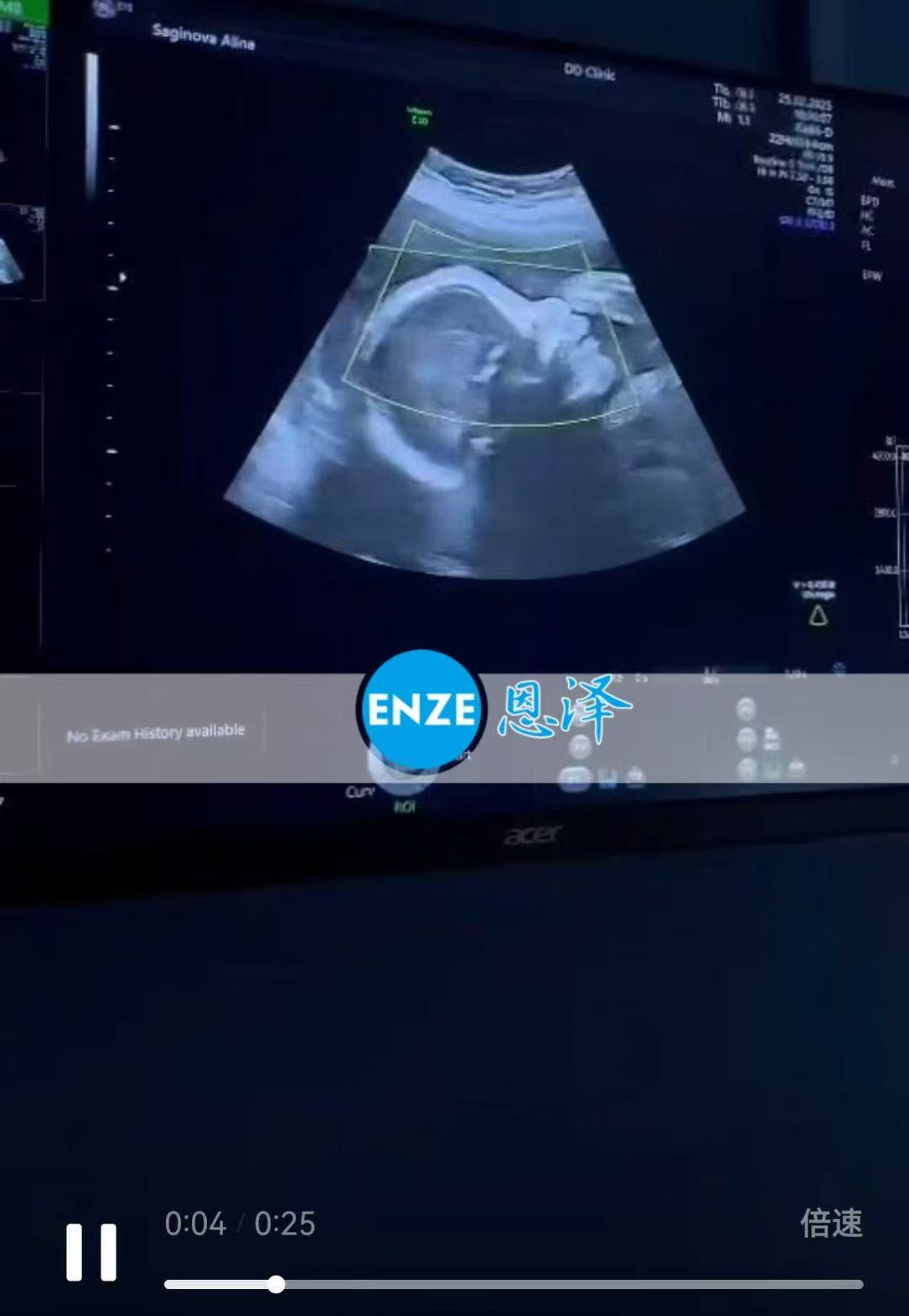 格鲁吉亚试管婴儿助孕爱心使者24周产检顺利通过