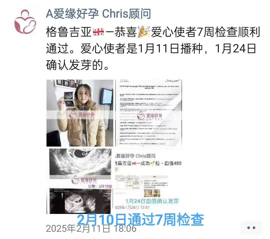 格鲁吉亚试管婴儿助孕爱心使者8周+4天产检顺利通过