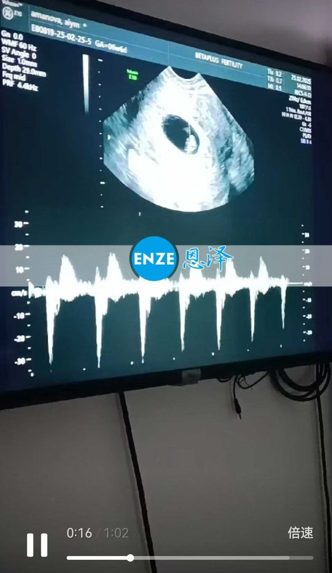 格鲁吉亚试管婴儿助孕爱心使者6周产检顺利通过