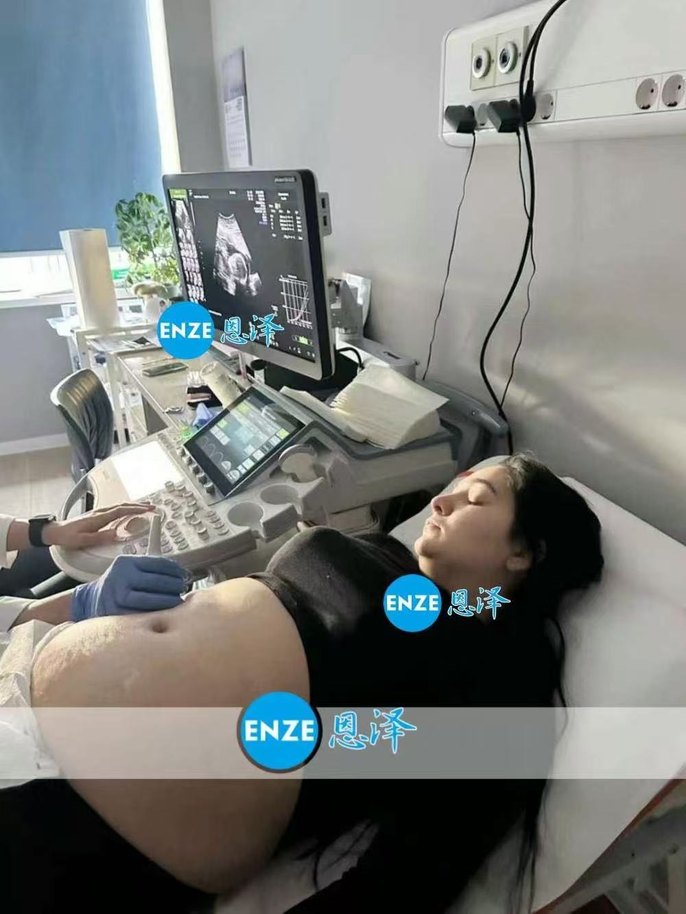 格鲁吉亚试管婴儿助孕爱心使者21周产检顺利通过