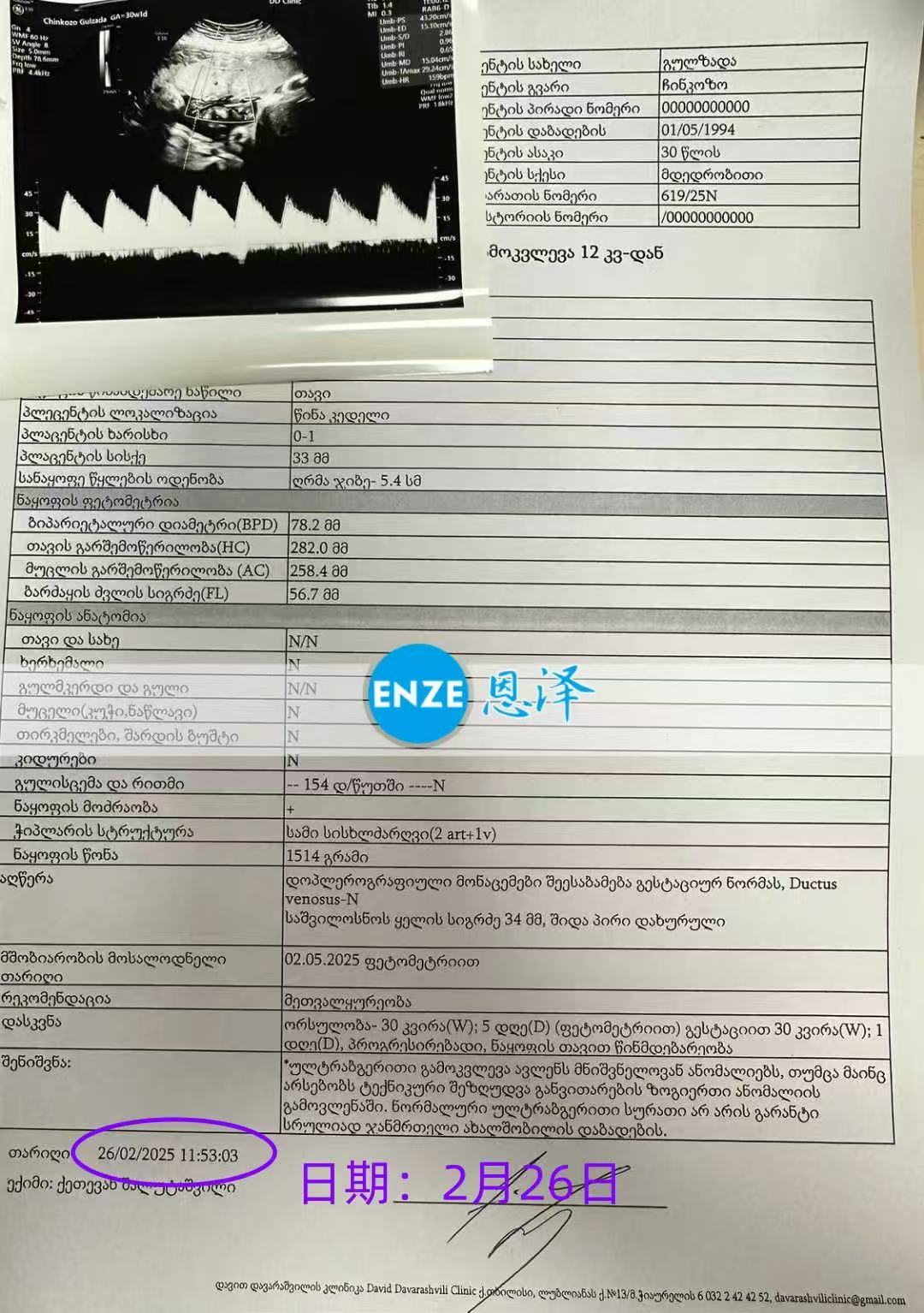 格鲁吉亚试管婴儿助孕爱心使者30周产检顺利通过