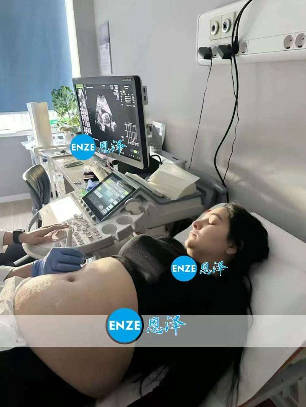 格鲁吉亚试管婴儿助孕爱心使者21周产检顺利通过