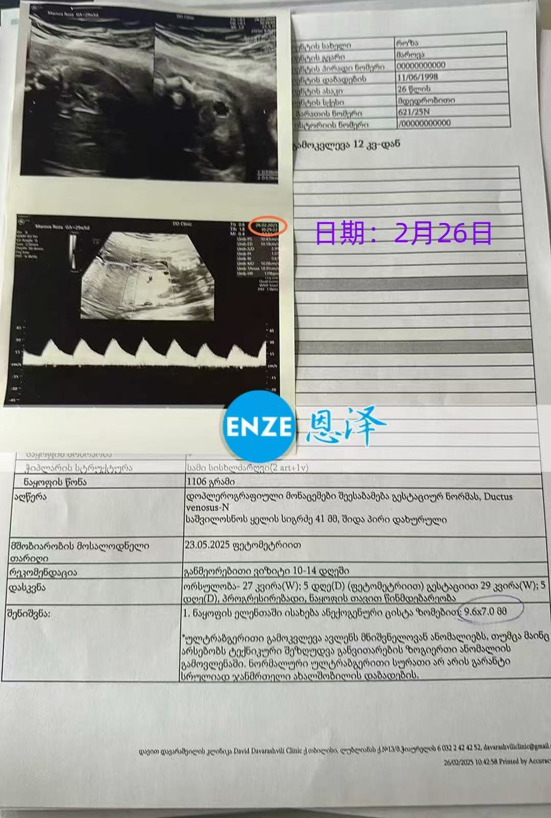 格鲁吉亚试管婴儿助孕爱心使者29周产检顺利通过
