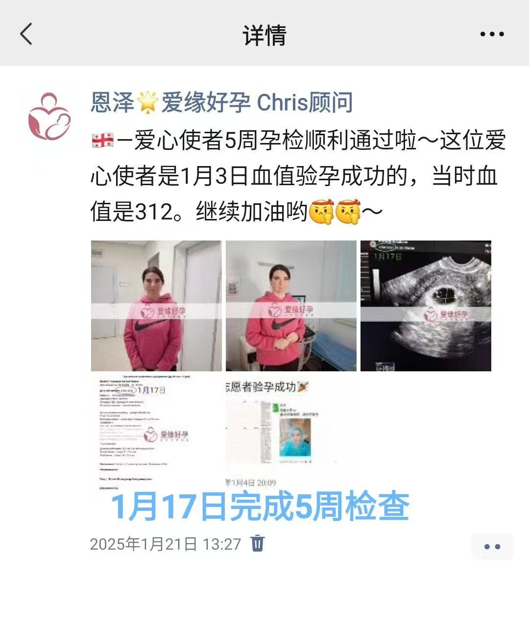 格鲁吉亚试管婴儿助孕爱心使者12周产检顺利，步入稳定期