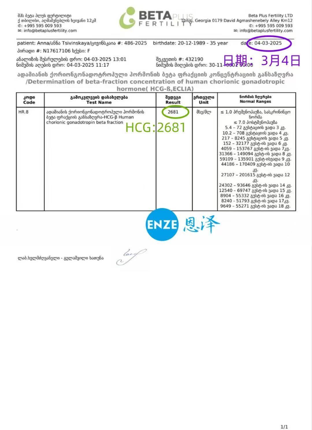 格鲁吉亚试管婴儿助孕爱心使者着床成功