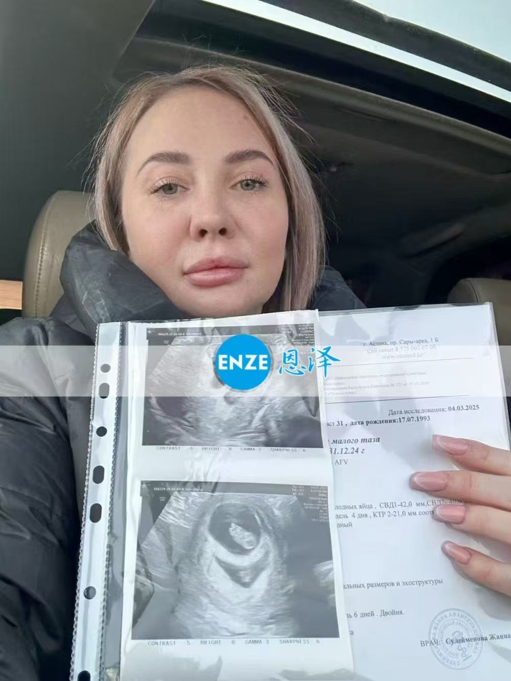 格鲁吉亚试管婴儿助孕爱心使者8周产检顺利通过