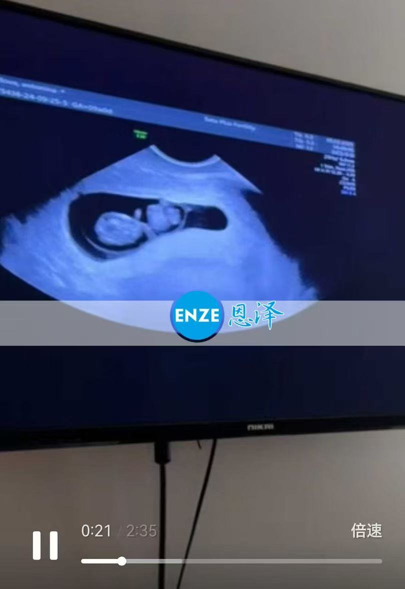 格鲁吉亚试管婴儿助孕爱心使者9周产检顺利通过