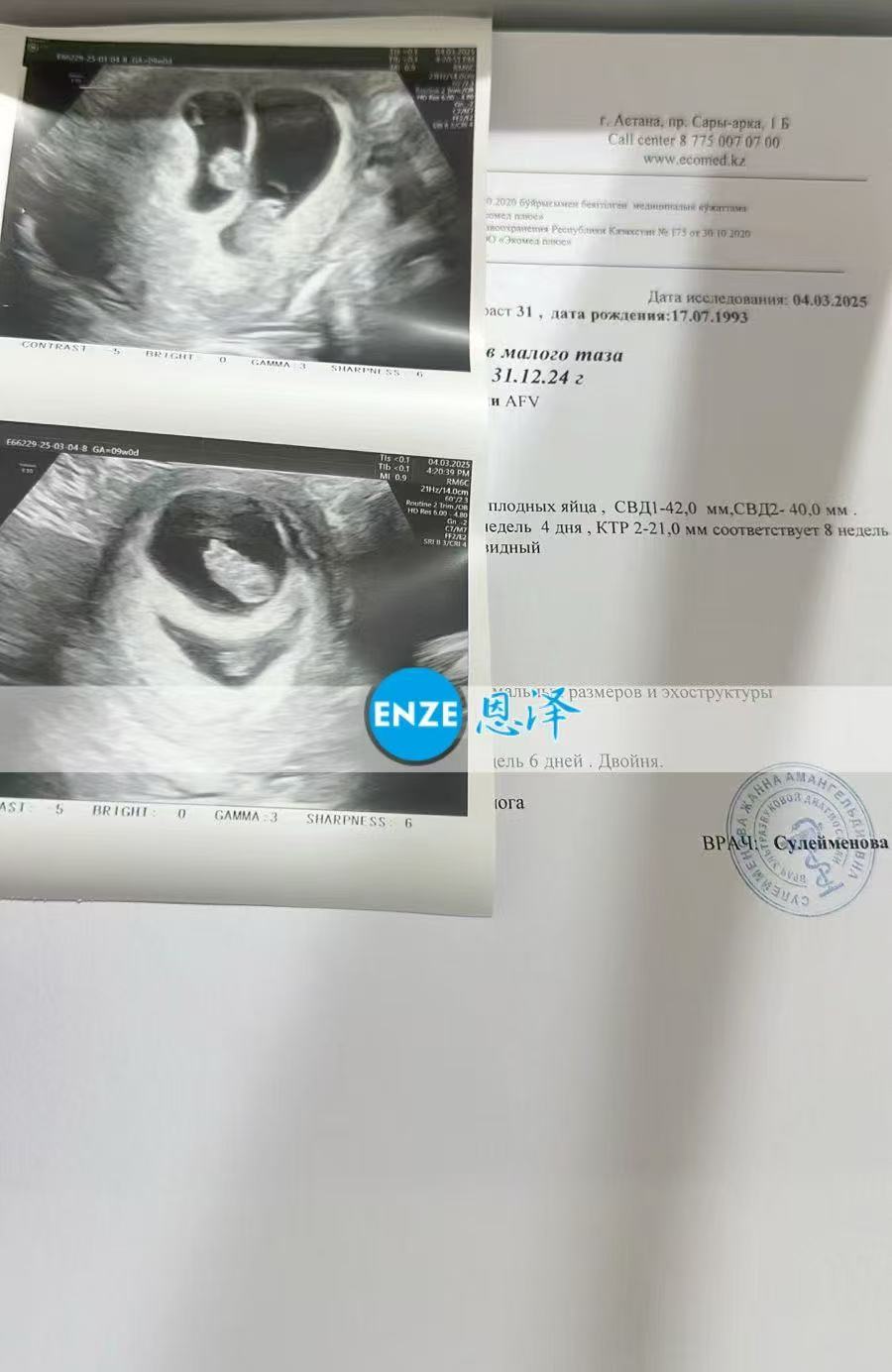 格鲁吉亚试管婴儿助孕爱心使者8周产检顺利通过