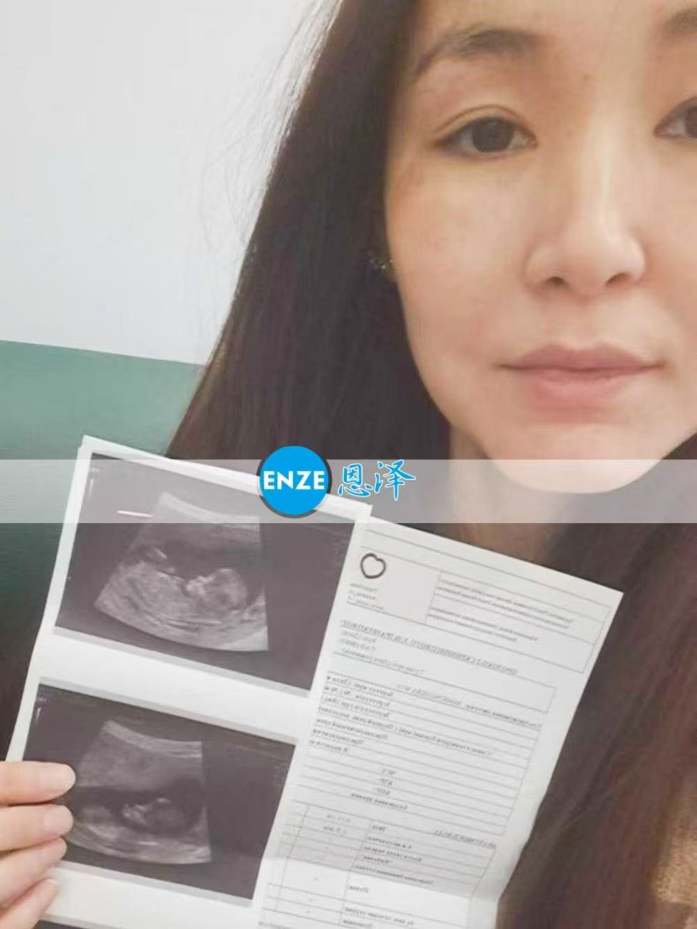 格鲁吉亚试管婴儿助孕爱心使者8周产检进展顺利
