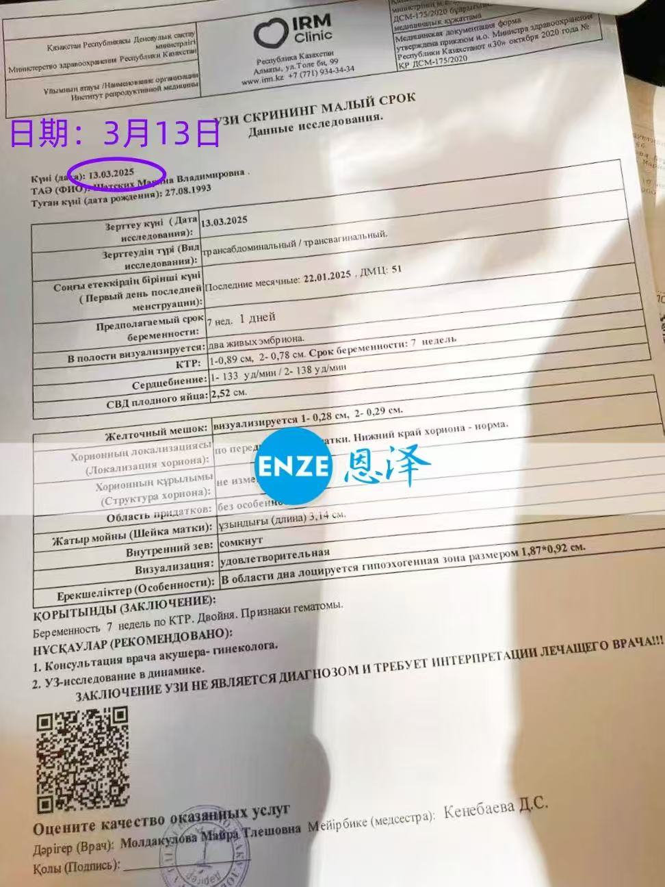 哈萨克斯坦试管婴儿助孕爱心使者移植胚胎分裂，孕育同暖双胞胎