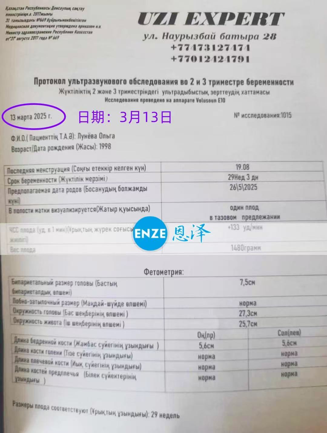 哈萨克斯坦试管婴儿助孕爱心使者29周产检进展顺利