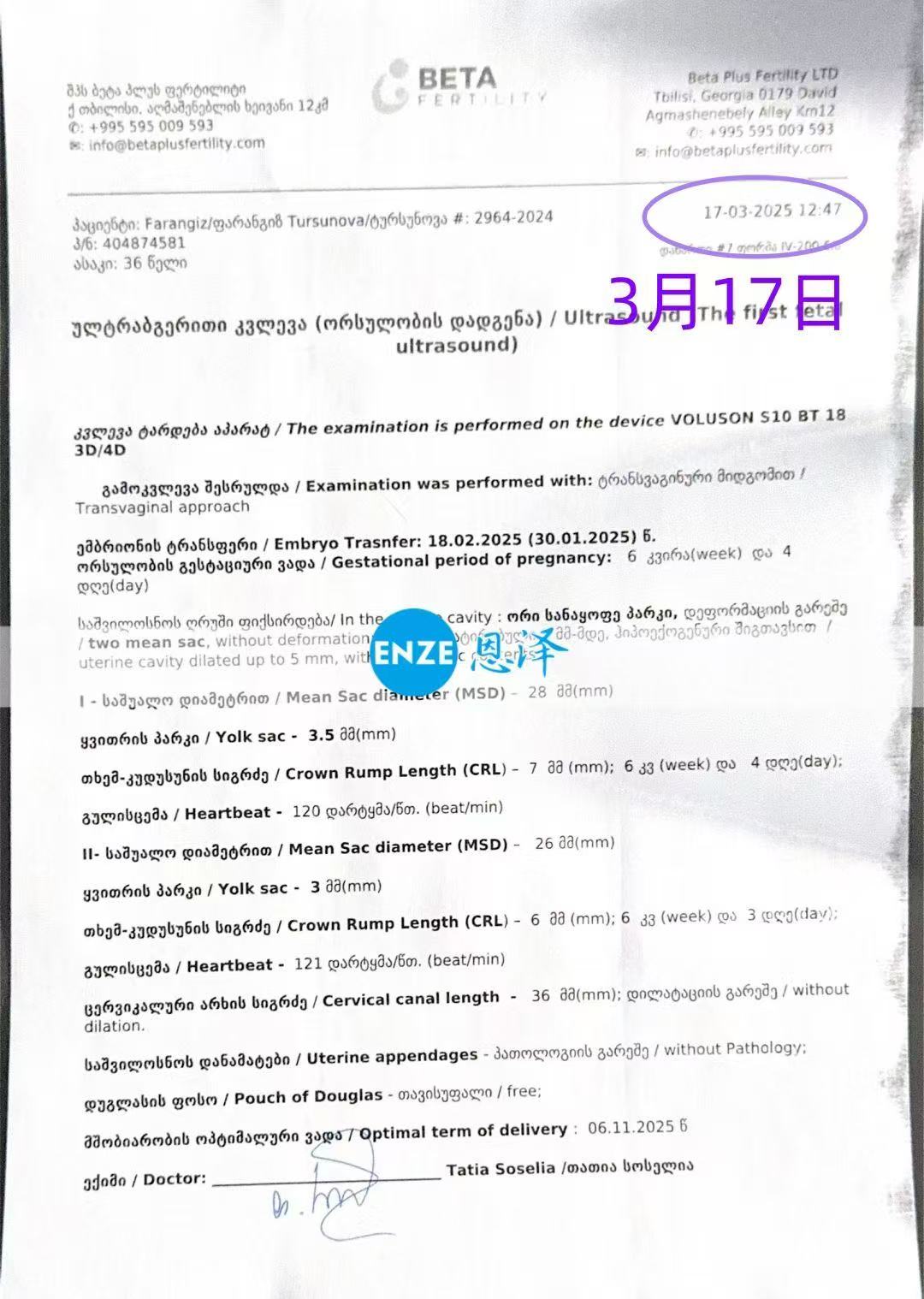 格鲁吉亚试管婴儿助孕爱心使者首次产检确认怀上双胎