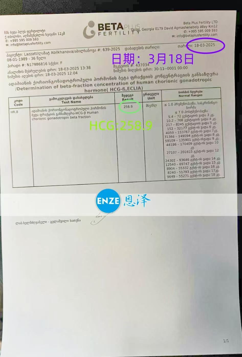 格鲁吉亚试管婴儿助孕爱心使者顺利着床