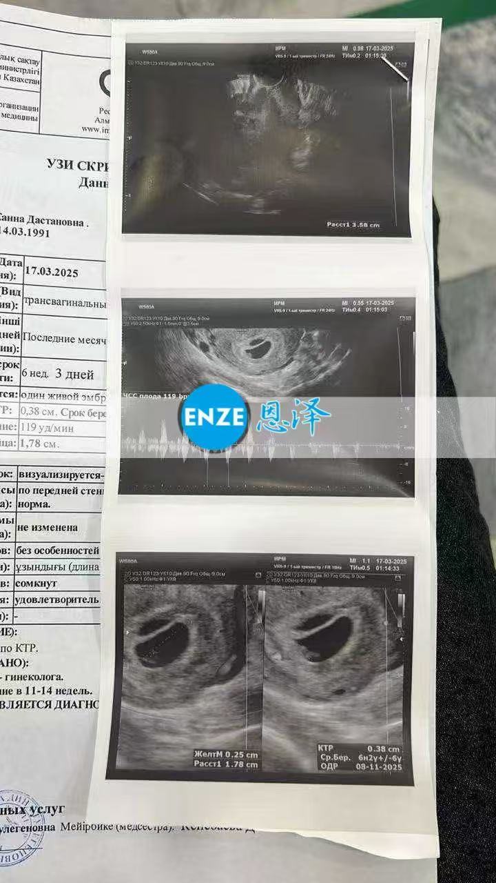 哈萨克斯坦试管婴儿助孕爱心使者6周产检顺利通过
