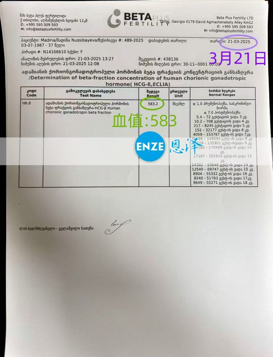 格鲁吉亚试管婴儿助孕爱心使者着床成功