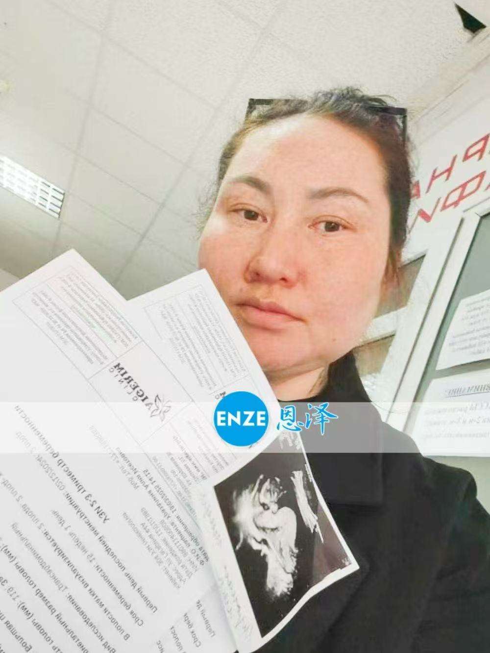 格鲁吉亚试管婴儿助孕爱心使者顺利通过16周产检