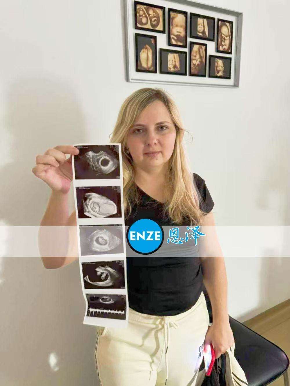 格鲁吉亚试管婴儿助孕爱心使者9周产检顺利通过