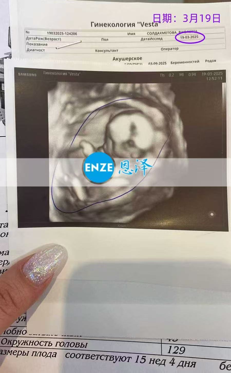 格鲁吉亚试管婴儿助孕爱心使者15周产检顺利通过