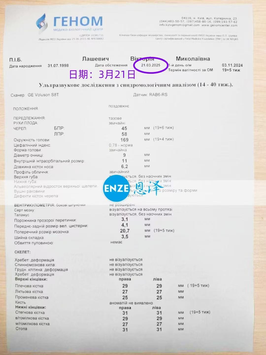 乌克兰试管婴儿助孕爱心使者19周产检顺利过关