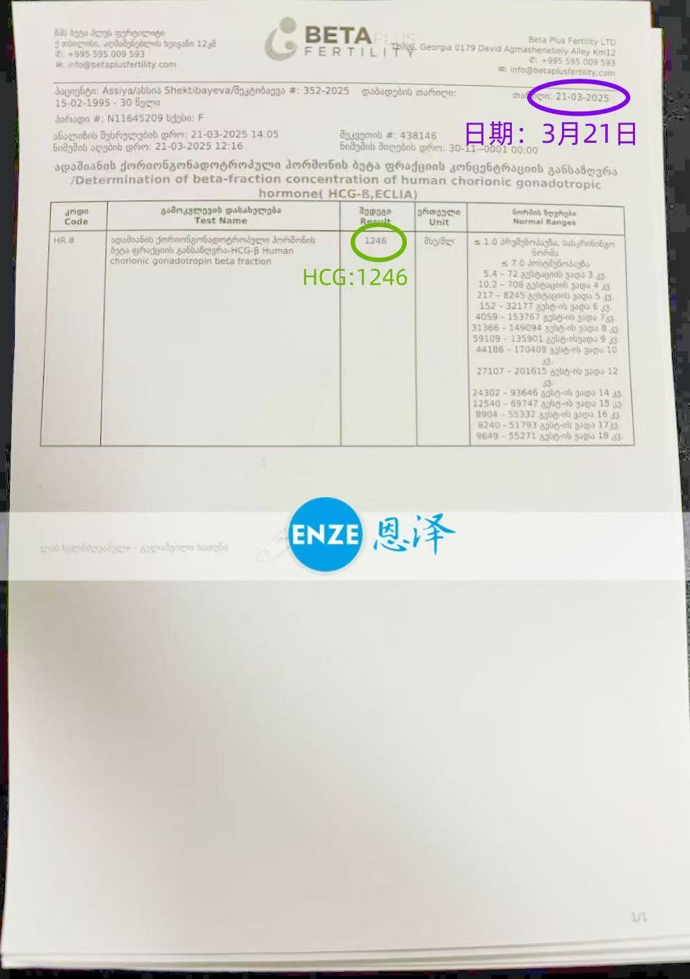 格鲁吉亚试管婴儿助孕爱心使者胚胎成功着床
