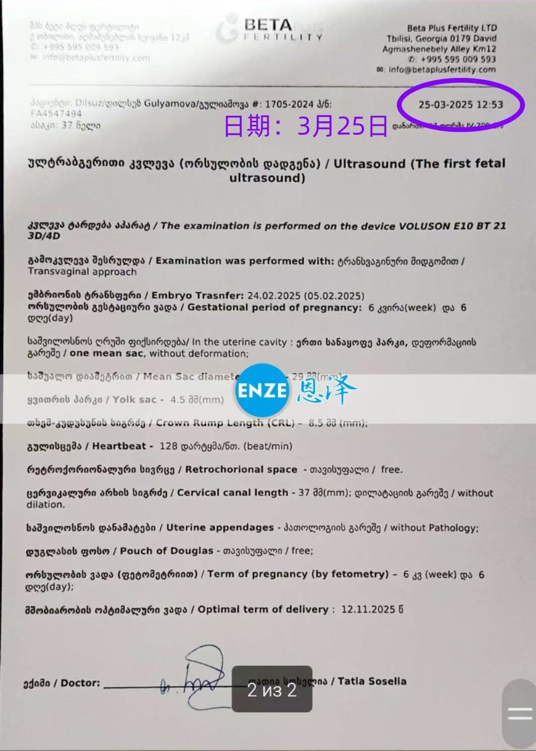 格鲁吉亚试管婴儿助孕爱心使者6周产检顺利通过