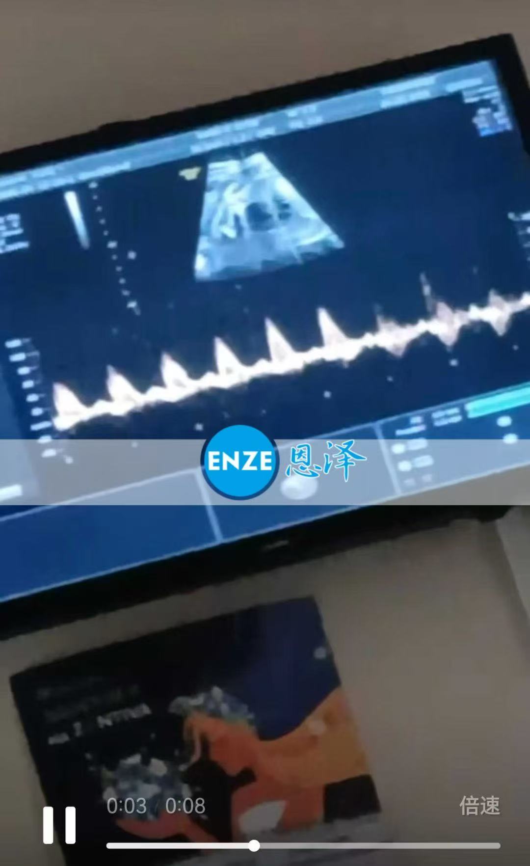乌克兰试管婴儿助孕爱心使者26周产检顺利过关