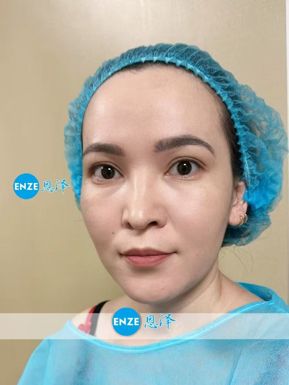 格鲁吉亚试管婴儿助孕爱心使者顺利完成移植