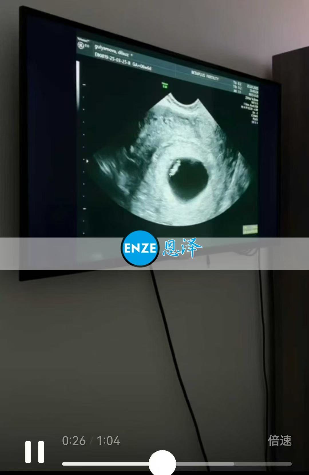 格鲁吉亚试管婴儿助孕爱心使者6周产检顺利通过