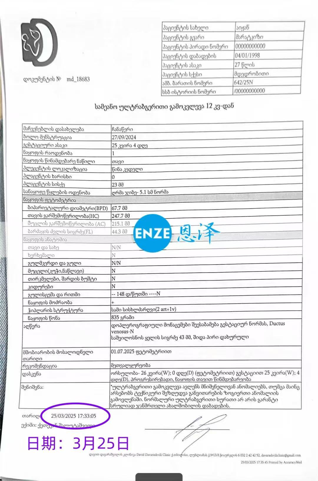 格鲁吉亚试管婴儿助孕爱心使者26周产检顺利通过