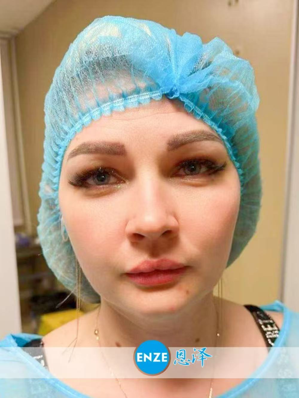格鲁吉亚试管婴儿助孕爱心使者顺利完成移植