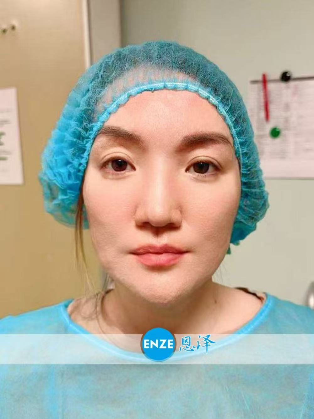 格鲁吉亚试管婴儿助孕爱心使者移植顺利，静待着床