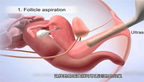 必知！做试管婴儿前的全方位准备工作大盘点