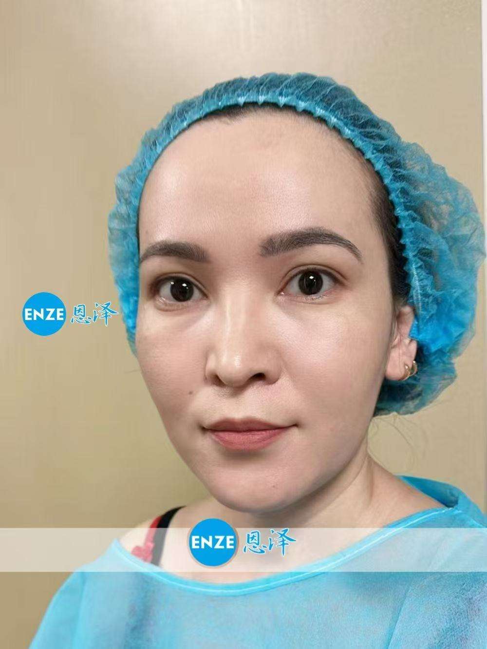 格鲁吉亚试管婴儿助孕爱心使者成功着床