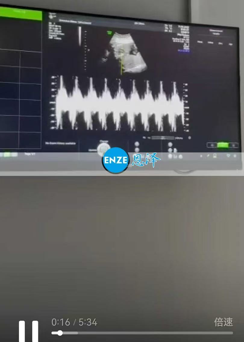 格鲁吉亚试管婴儿助孕爱心使者22周产检顺利通过