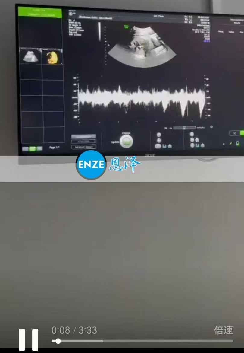 格鲁吉亚试管婴儿助孕爱心使者36周产检顺利通过
