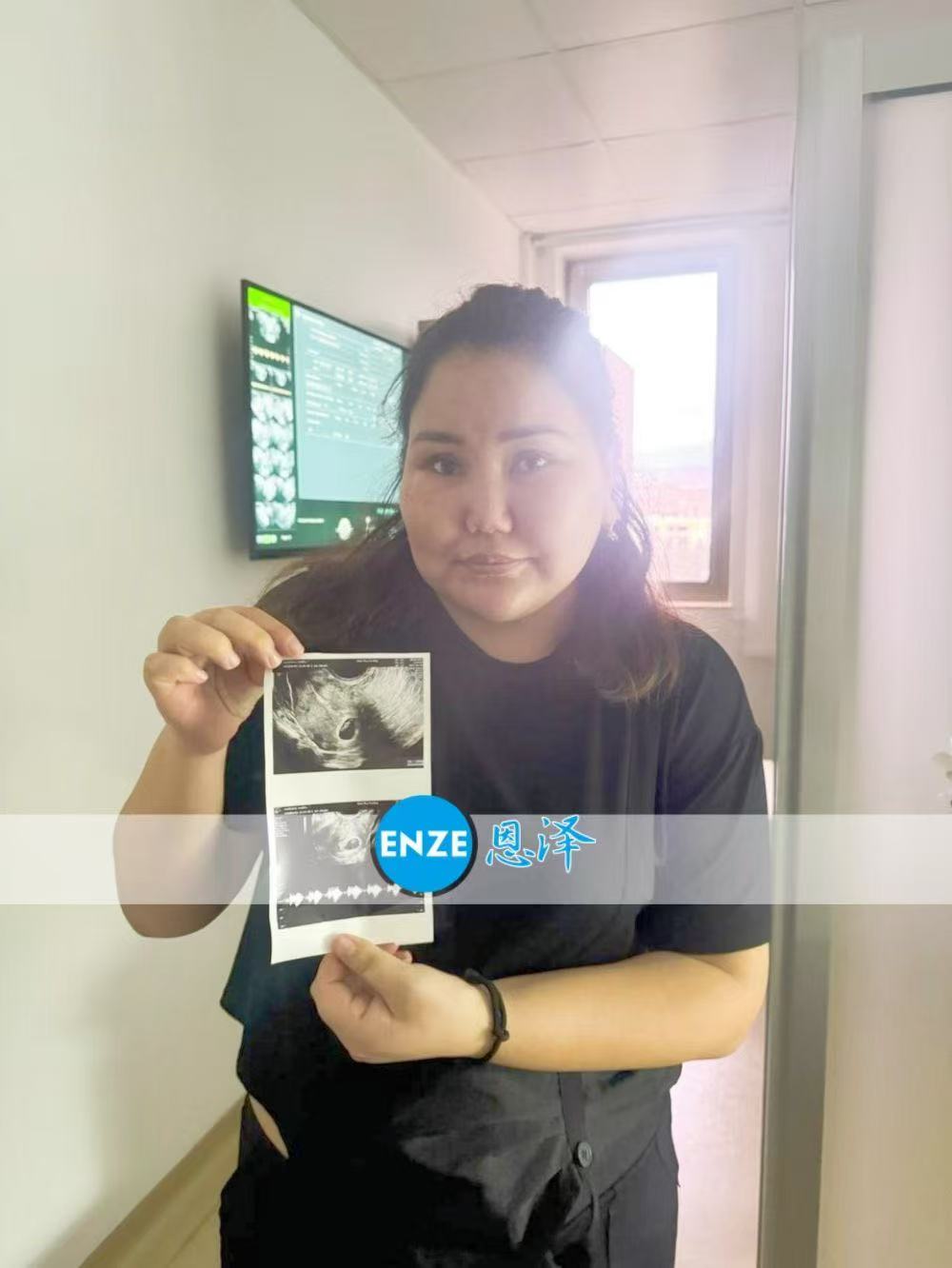 格鲁吉亚试管婴儿助孕爱心使者第一次产检顺利通过