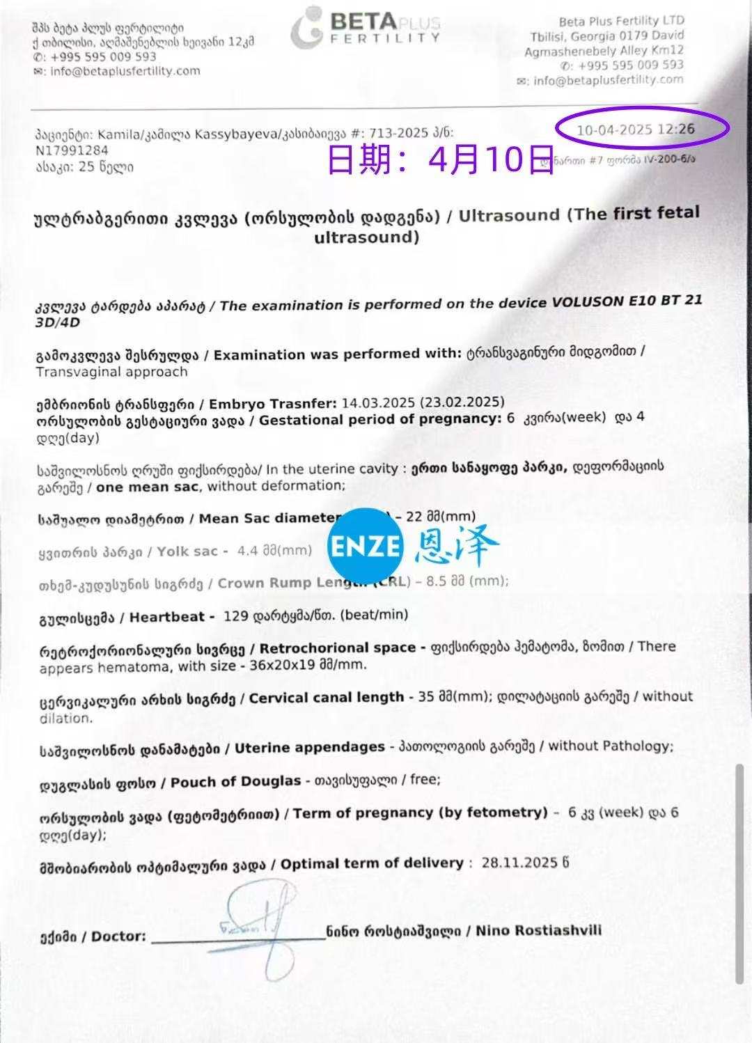 格鲁吉亚试管婴儿助孕爱心使者顺利通过6周首检