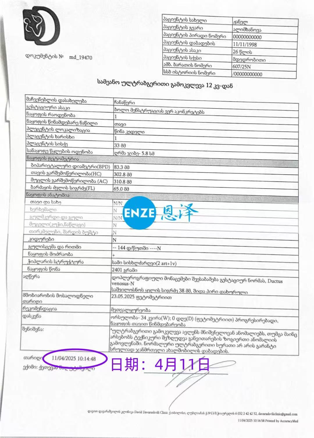 格鲁吉亚试管婴儿助孕爱心使者34周产检顺利通过