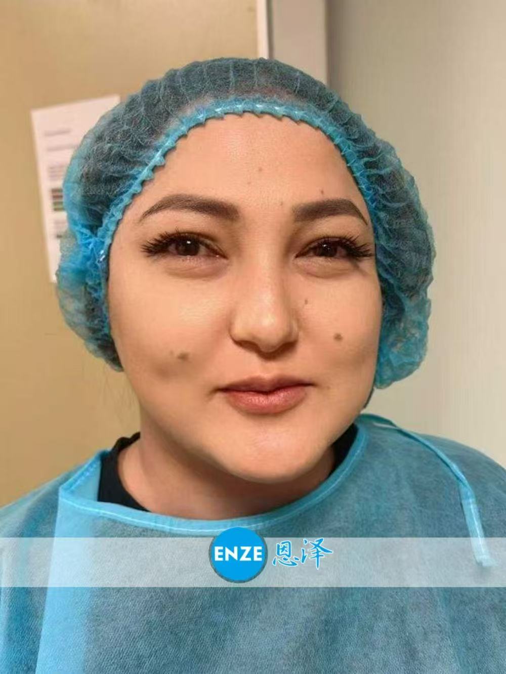 格鲁吉亚试管婴儿助孕爱心使者成功完成移植