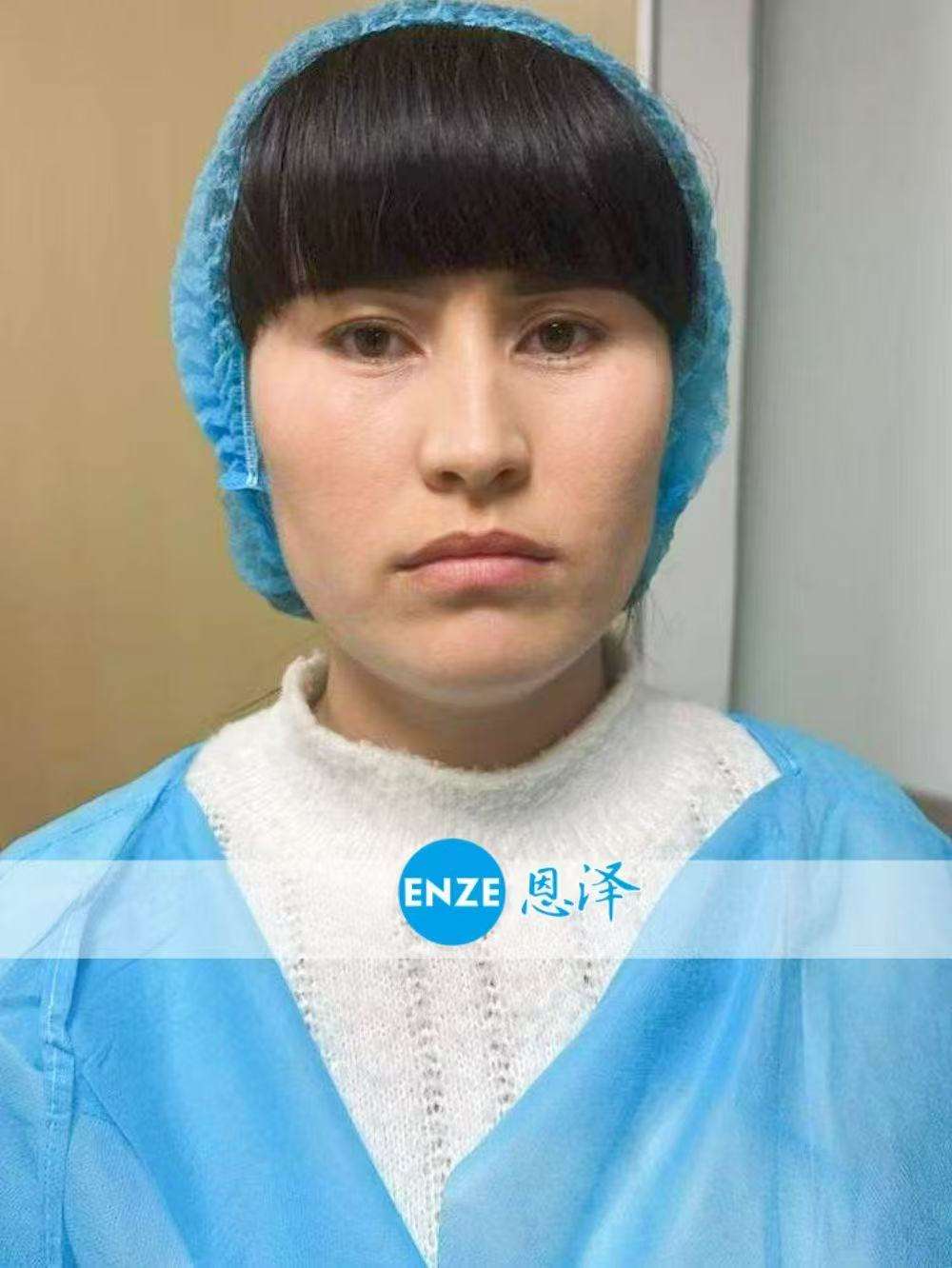 格鲁吉亚试管婴儿助孕爱心使者顺利完成移植