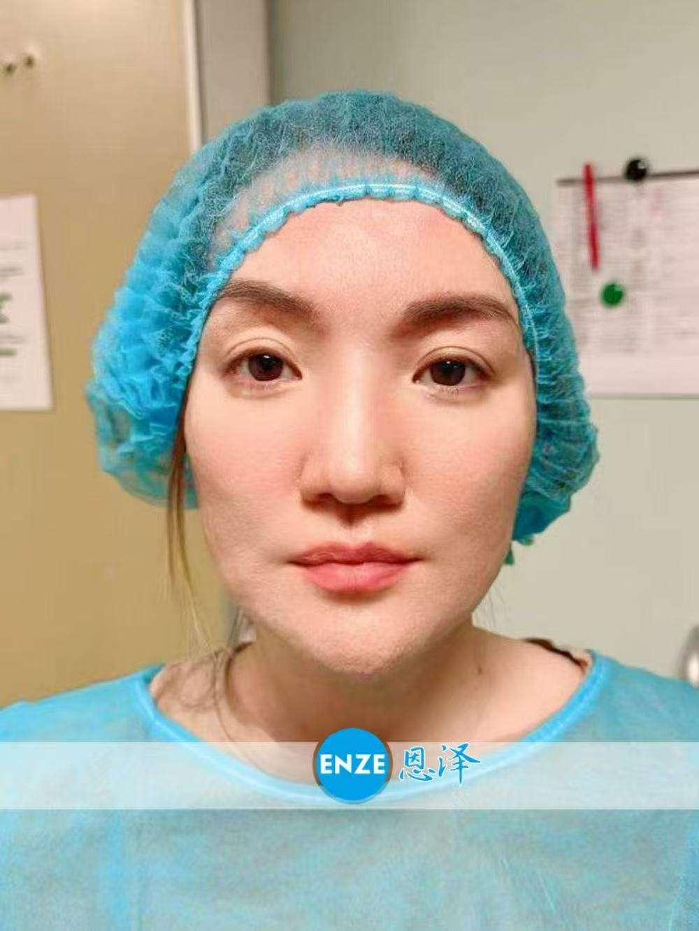 格鲁吉亚试管婴儿助孕爱心使者着床成功