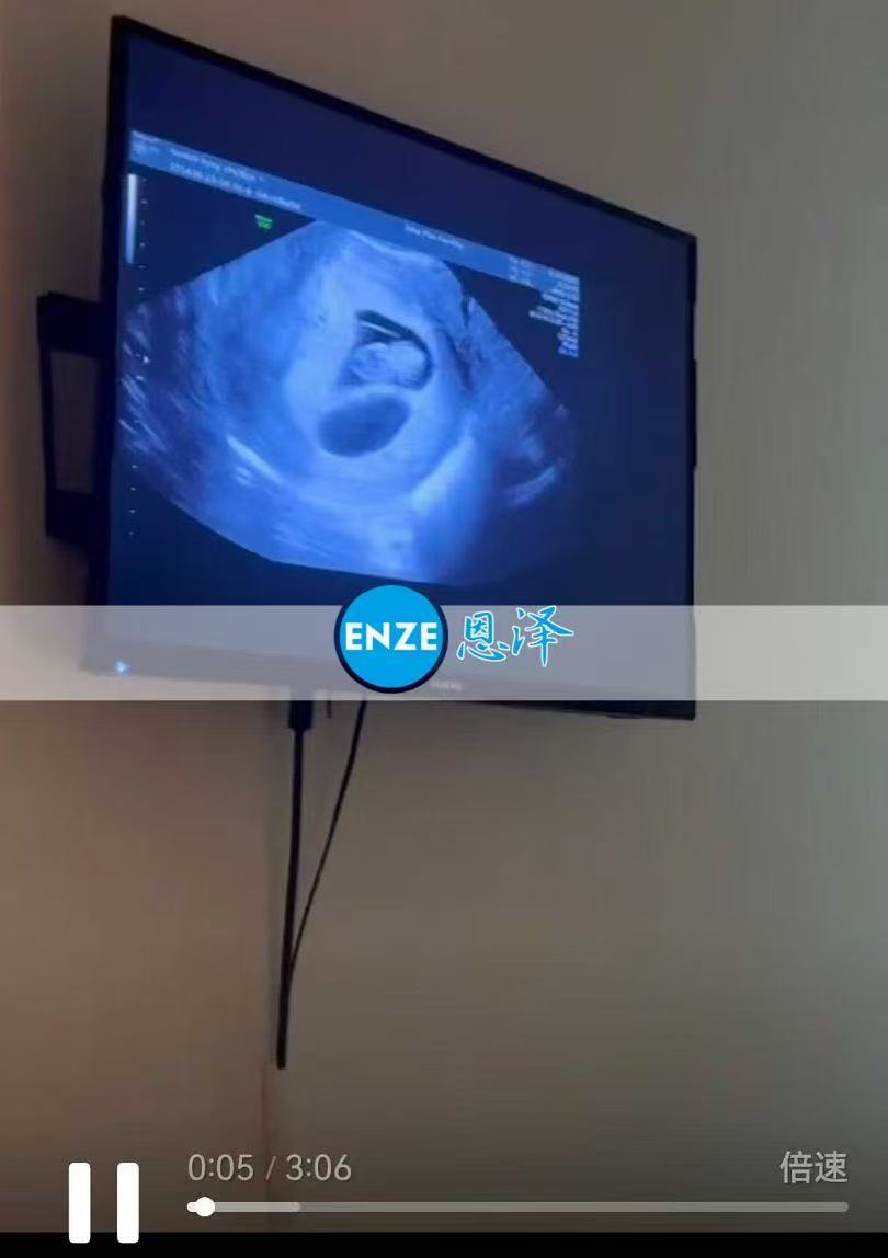 格鲁吉亚试管婴儿助孕爱心使者8周产检顺利通过