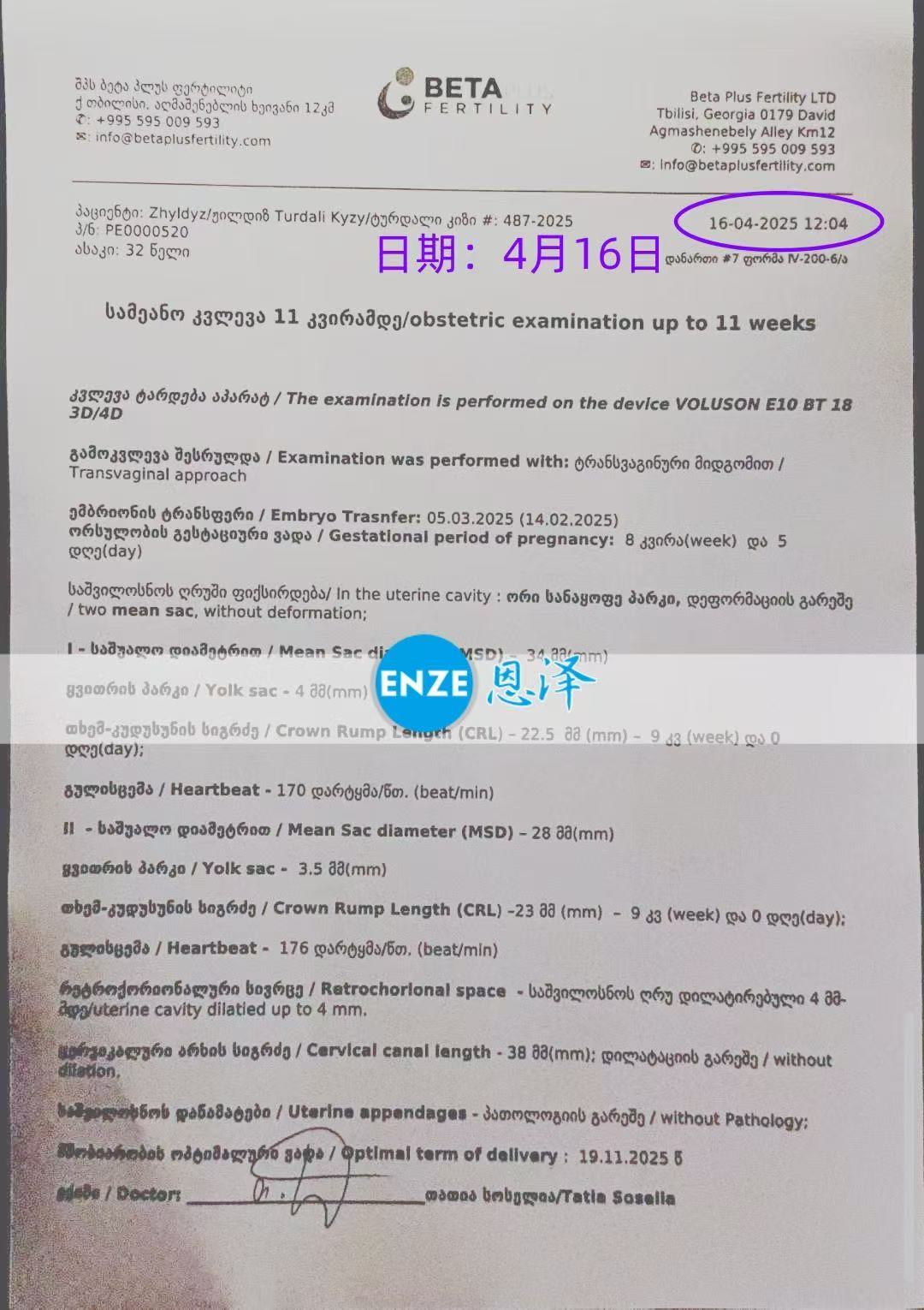 格鲁吉亚试管婴儿助孕爱心使者8周产检顺利通过