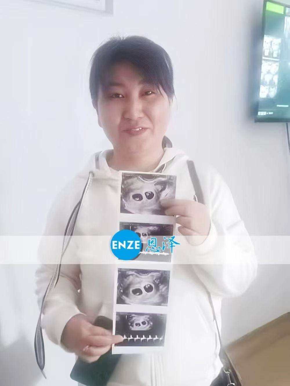 格鲁吉亚试管婴儿助孕爱心使者成功怀上双胎