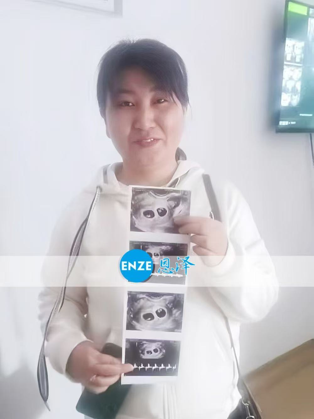 格鲁吉亚试管婴儿助孕爱心使者成功怀上双胎