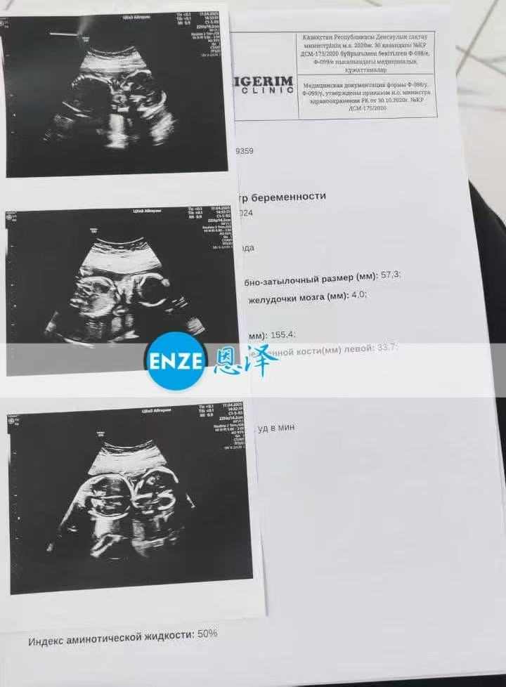格鲁吉亚试管婴儿助孕爱心使者20周产检顺利通过