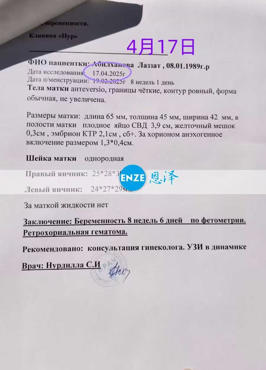 格鲁吉亚试管婴儿助孕爱心使者8周产检顺利过关