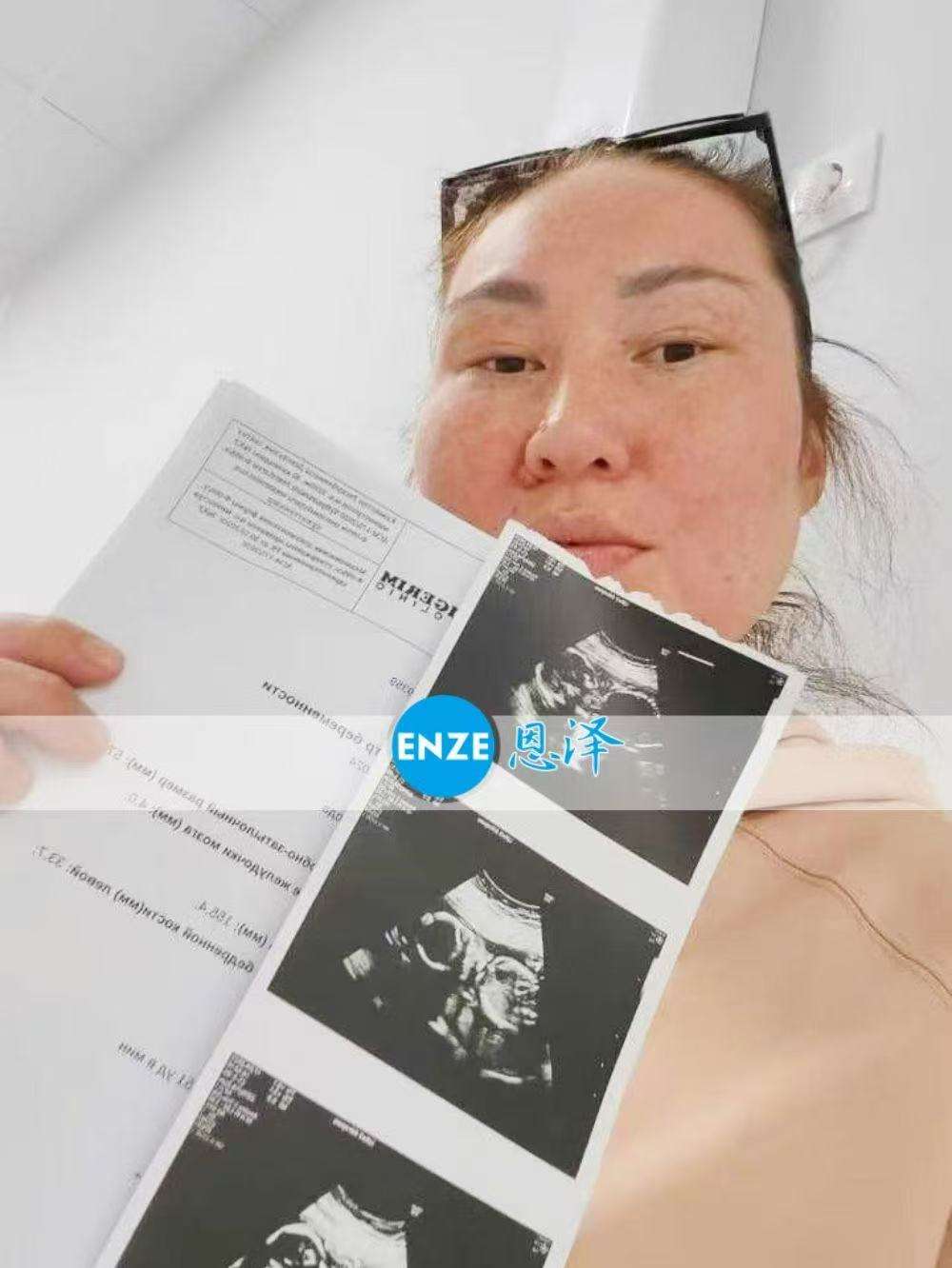 格鲁吉亚试管婴儿助孕爱心使者20周产检顺利通过
