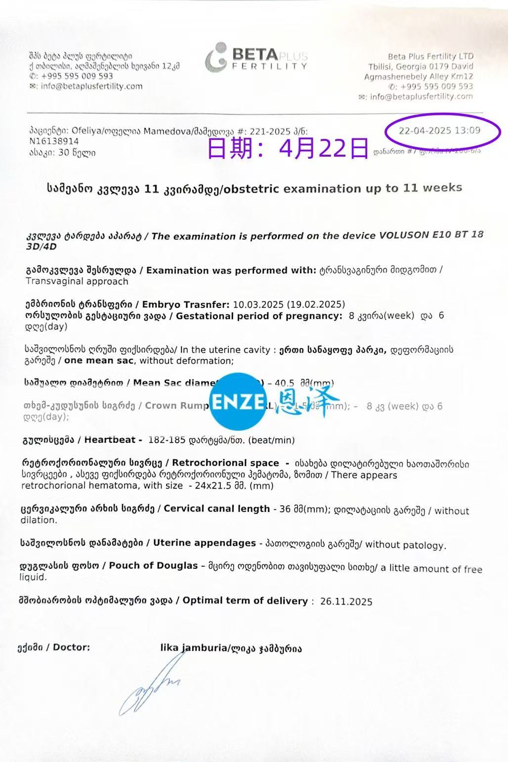 格鲁吉亚试管婴儿助孕爱心使者8周产检顺利过关